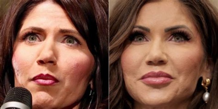 Abigail Cowen Plastic Surgery – Before And After Pictures