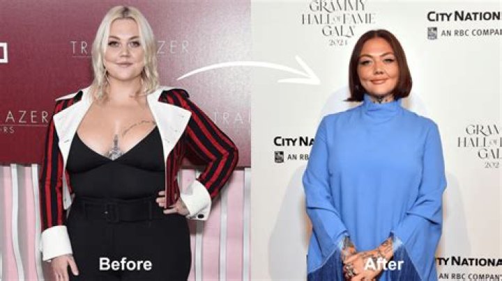 Did Elle King Get Plastic Surgery? Has Elle King Lost Weight?