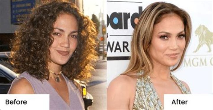 Did Jennifer Lopez Get Her Nose Done? Plastic Surgery Before And After