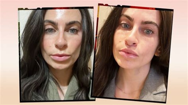 Fans Claim That Catherine Reitman Upper Lip Before Botched Surgery Resembles Father Ivan Reitman Lips