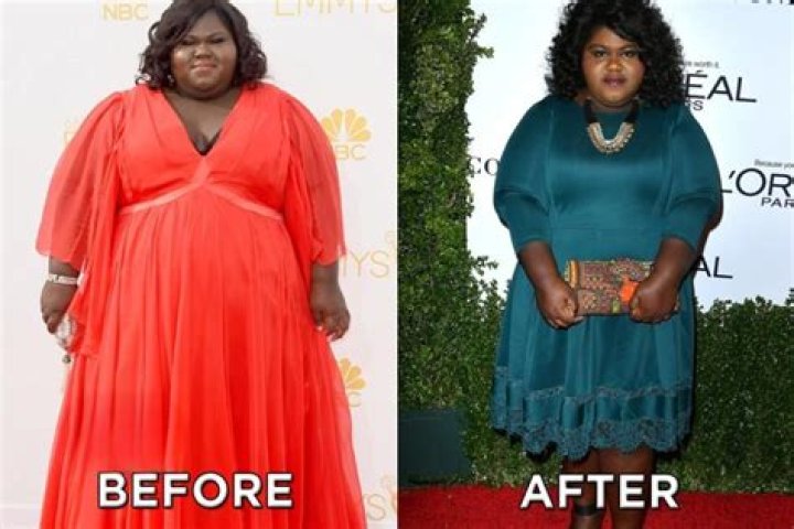 
Gabourey Sidibe Weight Loss Before and After Surgery Photos And More 