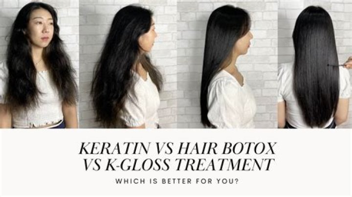 
Inside Alec Baldwin’s Plastic Surgery: Fans Curious About Botox And Keratin 