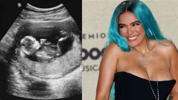 Karol G Pregnant: Is She Expecting A Baby Soon?