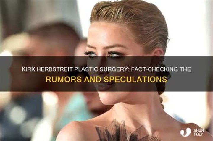 Kirk Herbstreit Plastic Surgery Update- What Happened To Him?
