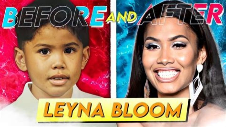 
Leyna Bloom Surgery Update: Transgender Model Parents Ethnicity Explored 