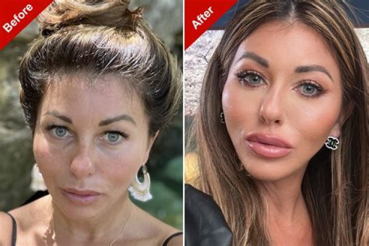 Ruby Wax Had A Plastic Surgery: Before & After Photos
