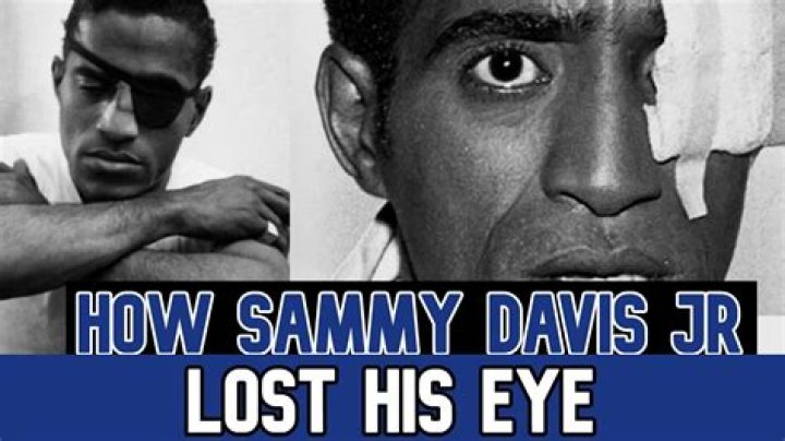 
Sammy Davis Jr Obituary, What was Sammy Davis Jr Cause of Death? 