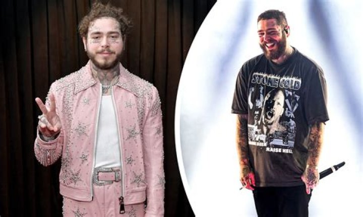 
Update on Post Malone: Singer postpones show after experiencing ‘stabbing pain’ 