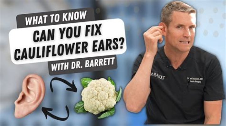 
What Happened To Andrew Davis’ Ear? How Do You Get Cauliflower Ear? 