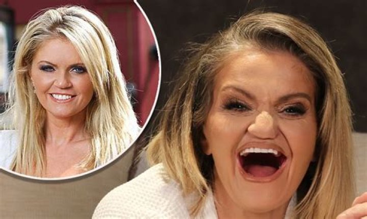 What Happened To Danniella Westbrook Septum? Timeline Of Everything She Has Done On Her Face