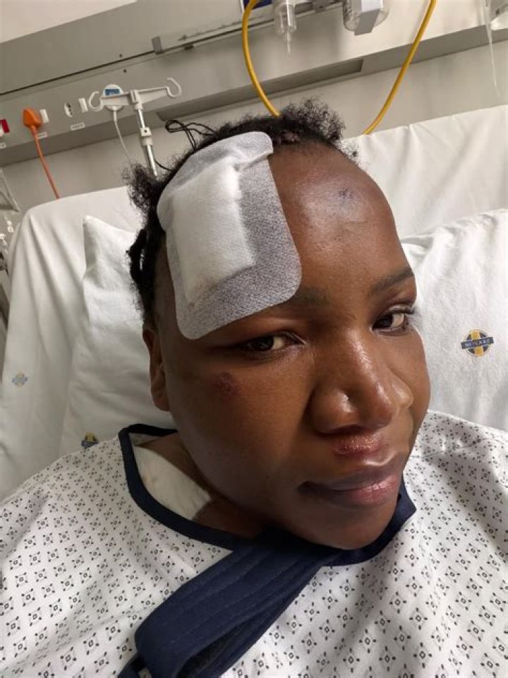 What Happened To Jackson Anthony? Hospitalized After Accident News, Where Is He Now?