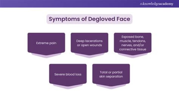 
What Is Degloved Face? TikTok Video and Meaning Explained 