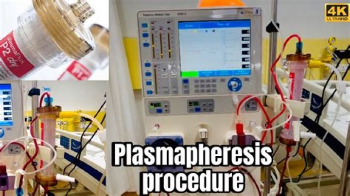 
What is plasmapheresis? All about the process in wake of Jo Lindner’s tragic death at 30 