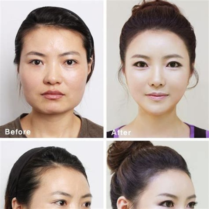 
Zhou Chuan Before And After Plastic Surgery – Age And Ethnicity Revealed 